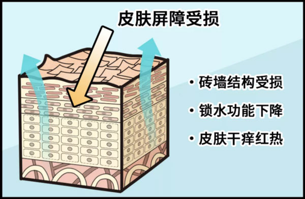 皮肤屏障受损 皮肤屏障受损后应该如何修护?